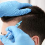 毛髪再生医療の「HARG療法」の効果・施術方法・副作用について