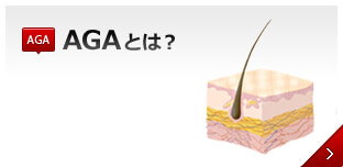 AGAとは？男性型脱毛症の事。果たしてそのメカニズムとは、どの様な物なのでしょう？