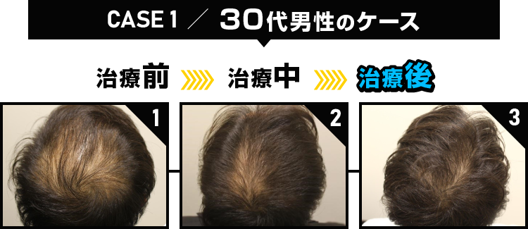 CASE1 30代男性のケース