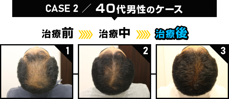 CASE2 40代男性のケース