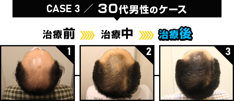 CASE3 30代男性のケース