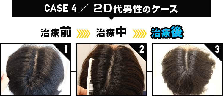 CASE4 20代男性のケース