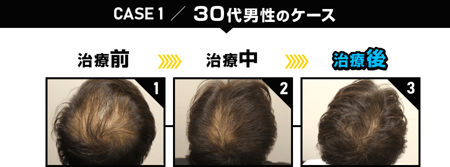 CASE1 30代男性のケース