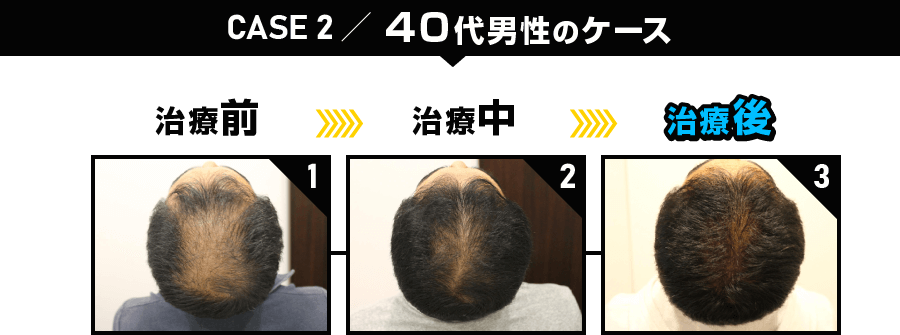 CASE2 40代男性のケース