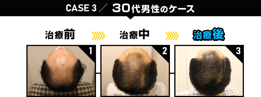 CASE3 30代男性のケース