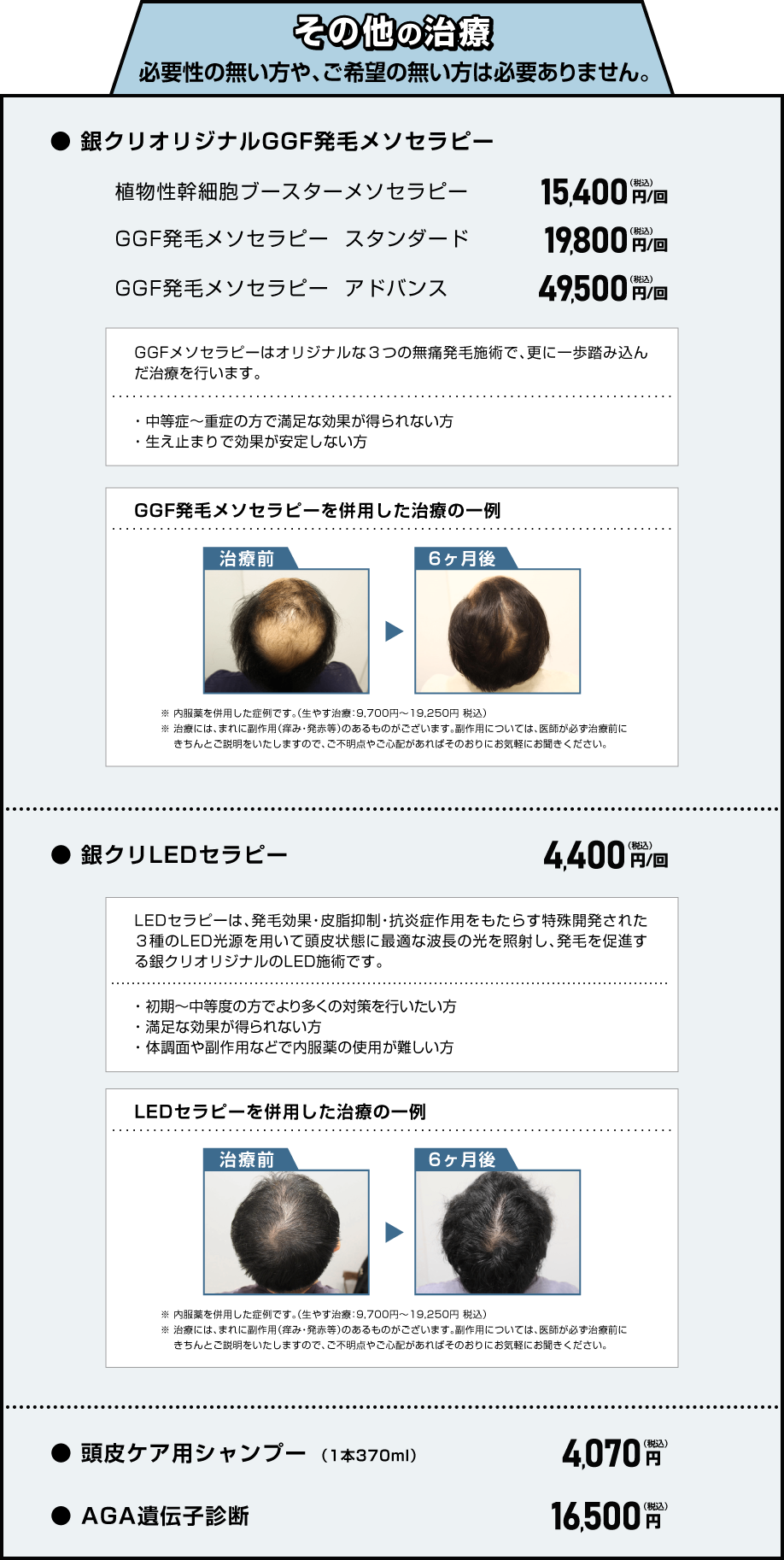 その他の治療