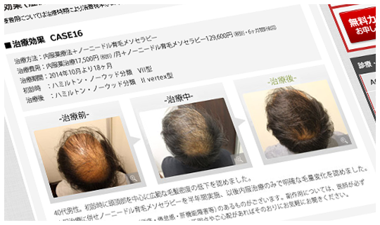 効果発現の目安、副作用