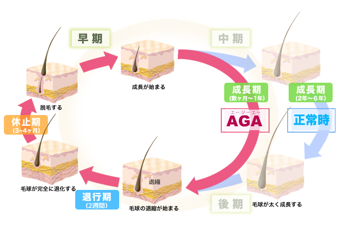 AGA（男性型脱毛症）の仕組み 毛周期（ヘアサイクル）の図説