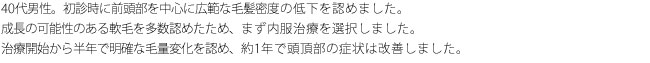 40代男性。初診時に前頭部を中心に広範な毛髪密度の低下を認めました。成長の可能性のある軟毛を多数認めたため、まず内服治療を選択しました。治療開始から半年で明確な毛量変化を認め、約1年で頭頂部の症状は改善しました。