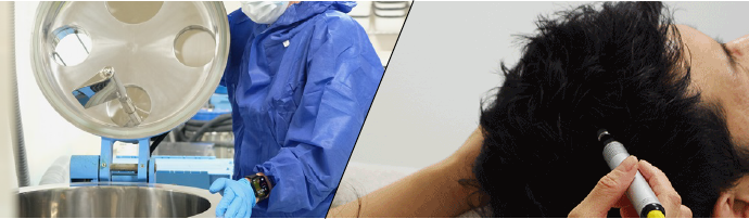 300通りを超えるAGA治療のバリエーションを用意