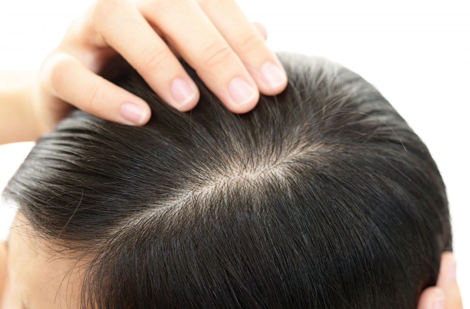 【医師監修】頭皮が臭い！？頭皮の匂い対策や予防方法について