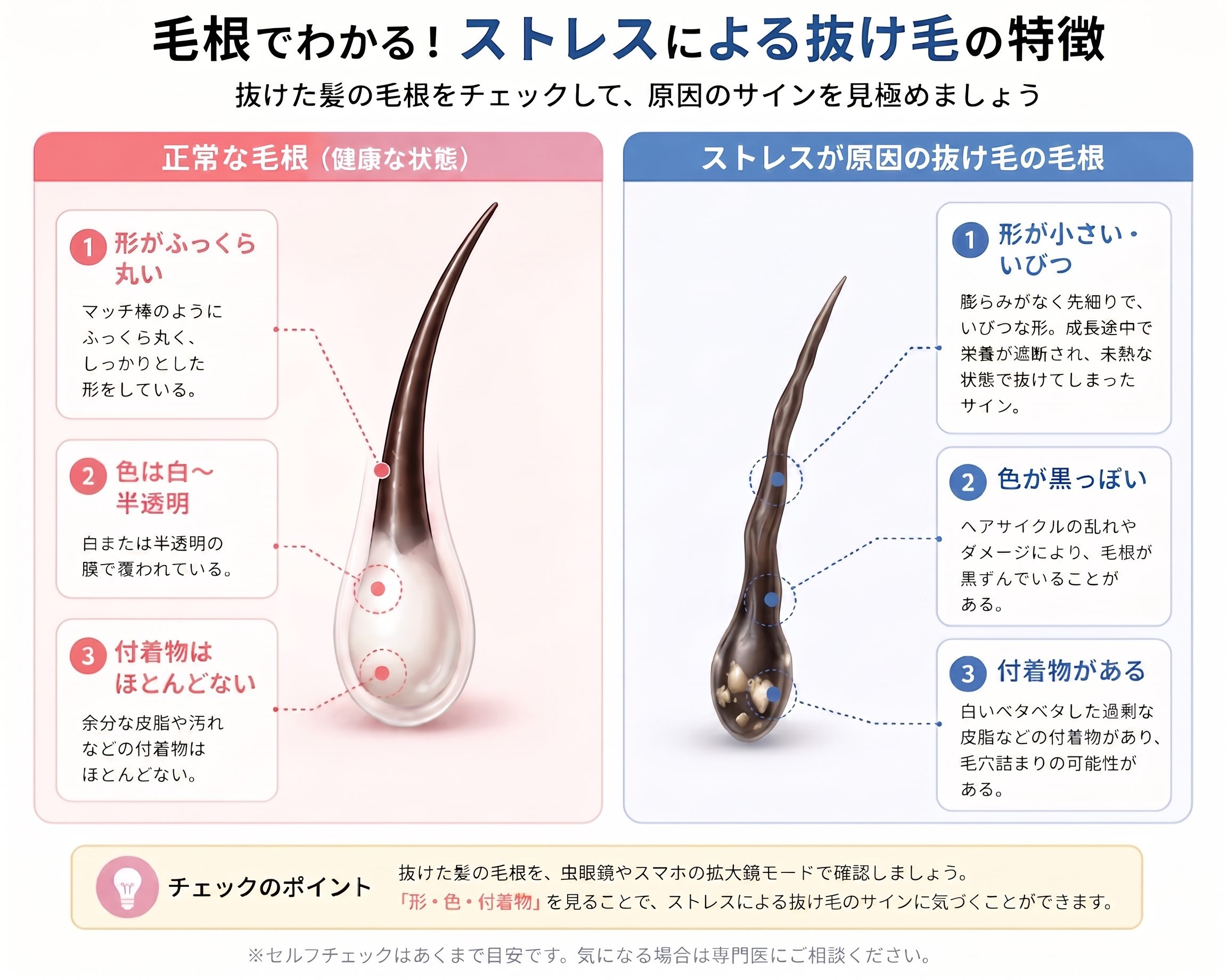ストレスによる抜け毛の特徴